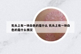 乳頭上有一塊白色的是什么 乳頭上有一塊白色的是什么情況