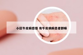 小區(qū)牛皮癬感悟 有牛皮病癬患者群嘛