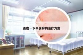 百度一下牛皮癬的治療方案