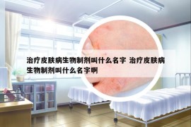 治療皮膚病生物制劑叫什么名字 治療皮膚病生物制劑叫什么名字啊