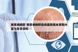 銀屑病麻醉 銀屑病麻醉指南最新版本更新內(nèi)容與背景資料