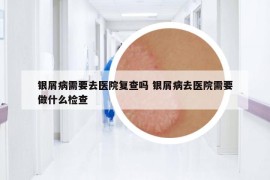 銀屑病需要去醫(yī)院復(fù)查嗎 銀屑病去醫(yī)院需要做什么檢查