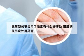 銀屑型關節(jié)炎用了激素有什么好壞處 銀屑病關節(jié)炎外用藥膏