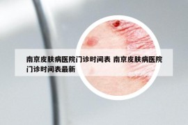 南京皮膚病醫(yī)院門診時間表 南京皮膚病醫(yī)院門診時間表最新