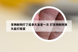 生物制劑打了后多久復(fù)查一次 打生物制劑多久能打疫苗
