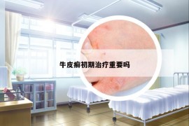牛皮癬初期治療重要嗎
