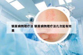 銀屑病物理療法 銀屑病物理療法幾次能有效果