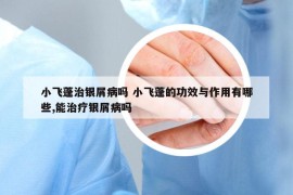 小飛蓬治銀屑病嗎 小飛蓬的功效與作用有哪些,能治療銀屑病嗎