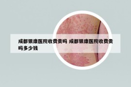 成都銀康醫(yī)院收費(fèi)貴嗎 成都銀康醫(yī)院收費(fèi)貴嗎多少錢