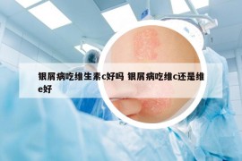 銀屑病吃維生素c好嗎 銀屑病吃維c還是維e好