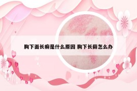 胸下面長癬是什么原因 胸下長蘚怎么辦