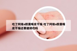吃了阿維a膠囊嘴皮干燥 吃了阿維a膠囊嘴皮干燥還要繼續(xù)吃嗎