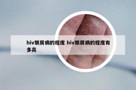 hiv銀屑病的程度 hiv銀屑病的程度有多高