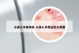 小孩人中有塊白 小孩人中旁邊長(zhǎng)小疙瘩