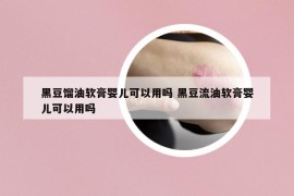 黑豆餾油軟膏嬰兒可以用嗎 黑豆流油軟膏嬰兒可以用嗎