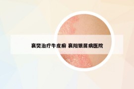 襄樊治療牛皮癬 襄陽銀屑病醫(yī)院