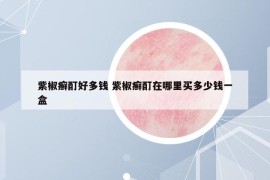 紫椒癬酊好多錢 紫椒癬酊在哪里買多少錢一盒