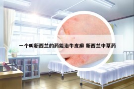 一個(gè)叫新西蘭的藥能治牛皮癬 新西蘭中草藥