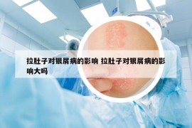 拉肚子對(duì)銀屑病的影響 拉肚子對(duì)銀屑病的影響大嗎