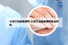 小蘇打治膿皰病嗎 小蘇打治膿皰病嗎能治好嗎