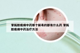 掌跖膿皰病中藥那個解毒的都有什么藥 掌跖膿皰病中藥治療方法