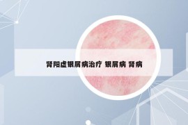 腎陽虛銀屑病治療 銀屑病 腎病