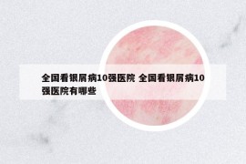 全國(guó)看銀屑病10強(qiáng)醫(yī)院 全國(guó)看銀屑病10強(qiáng)醫(yī)院有哪些