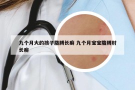 九個(gè)月大的孩子胳膊長(zhǎng)癬 九個(gè)月寶寶胳膊肘長(zhǎng)癬