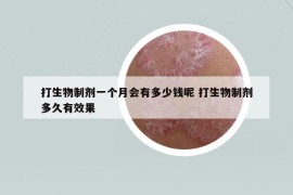 打生物制劑一個月會有多少錢呢 打生物制劑多久有效果