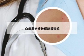 白癜風(fēng)治療社保能報(bào)銷嗎