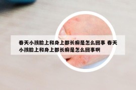 春天小孩臉上和身上都長癬是怎么回事 春天小孩臉上和身上都長癬是怎么回事啊