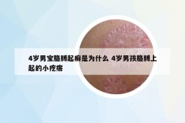 4歲男寶胳膊起癬是為什么 4歲男孩胳膊上起的小疙瘩