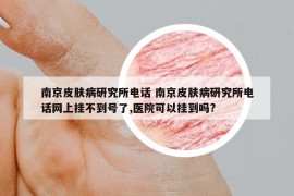 南京皮膚病研究所電話 南京皮膚病研究所電話網(wǎng)上掛不到號(hào)了,醫(yī)院可以掛到嗎?