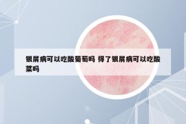 銀屑病可以吃酸葡萄嗎 得了銀屑病可以吃酸菜嗎