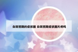 白斑初期的癥狀圖 白斑初期癥狀圖片疼嗎