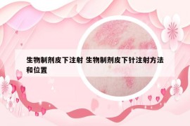 生物制劑皮下注射 生物制劑皮下針注射方法和位置