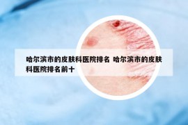 哈爾濱市的皮膚科醫(yī)院排名 哈爾濱市的皮膚科醫(yī)院排名前十