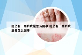 腿上有一層白皮是怎么回事 腿上有一層白皮屑是怎么回事