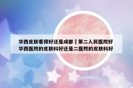 華西皮膚看得好還是成都巿第二人民醫(yī)院好 華西醫(yī)院的皮膚科好還是二醫(yī)院的皮膚科好