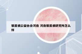 銀屑病公益協(xié)會河南 河南銀屑病研究所怎么樣
