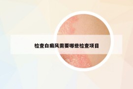 檢查白癜風需要哪些檢查項目