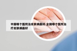 中國哪個(gè)醫(yī)院治皮膚病最好 全國哪個(gè)醫(yī)院治療皮膚病最好