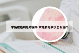掌跖膿皰病是咋回事 掌跖膿皰病該怎么治療