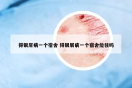 得銀屑病一個宿舍 得銀屑病一個宿舍能住嗎