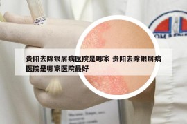 貴陽去除銀屑病醫(yī)院是哪家 貴陽去除銀屑病醫(yī)院是哪家醫(yī)院最好