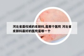 河北省最權(quán)威的皮膚科,是那個醫(yī)院 河北省皮膚科最好的醫(yī)院是哪一個