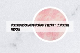 皮膚病研究所看牛皮癬哪個醫(yī)生好 去皮膚病研究所