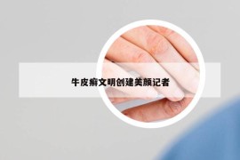 牛皮癬文明創(chuàng)建美顏記者