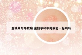 金錢草與牛皮癬 金錢草和牛蒡茶能一起喝嗎