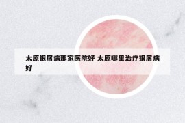 太原銀屑病那家醫(yī)院好 太原哪里治療銀屑病好